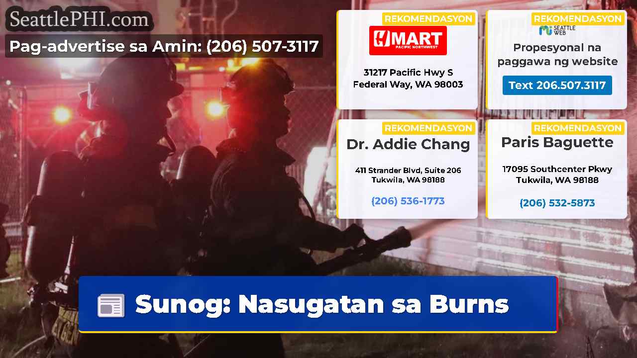 Sunog Nasugatan sa Burns