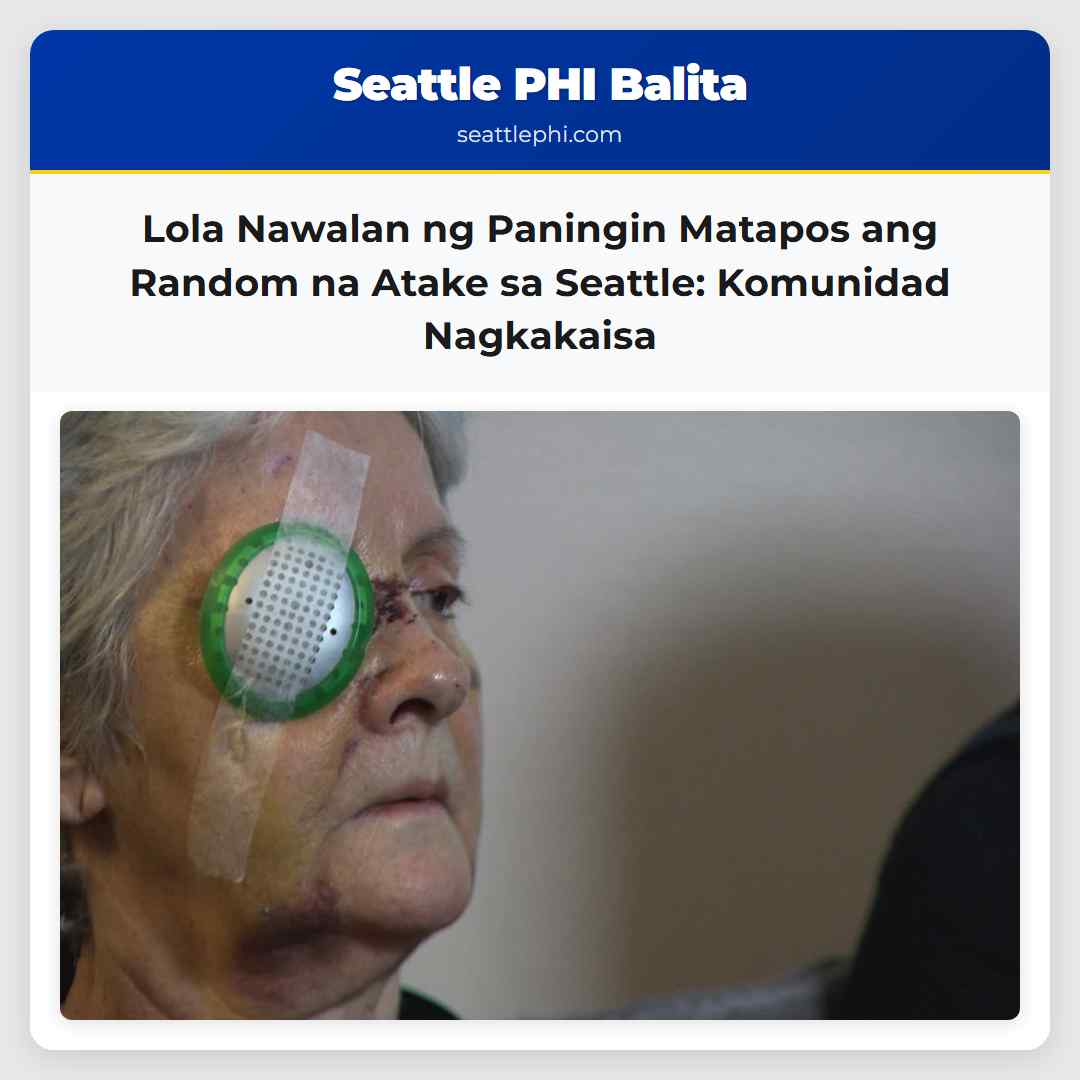 Lola Nawalan ng Paningin Matapos ang Random na