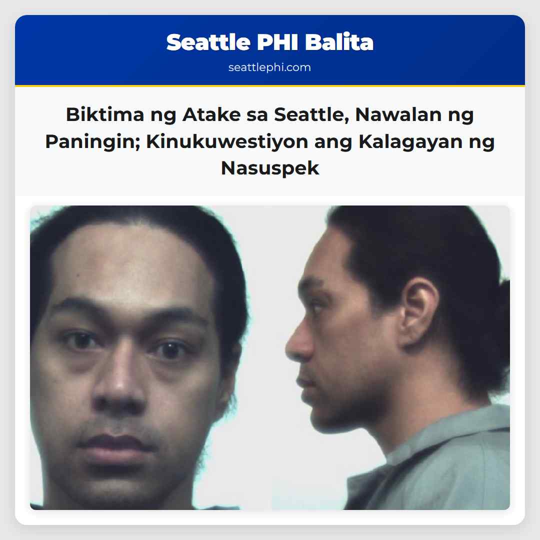 Biktima ng Atake sa Seattle, Nawalan ng Paningin;