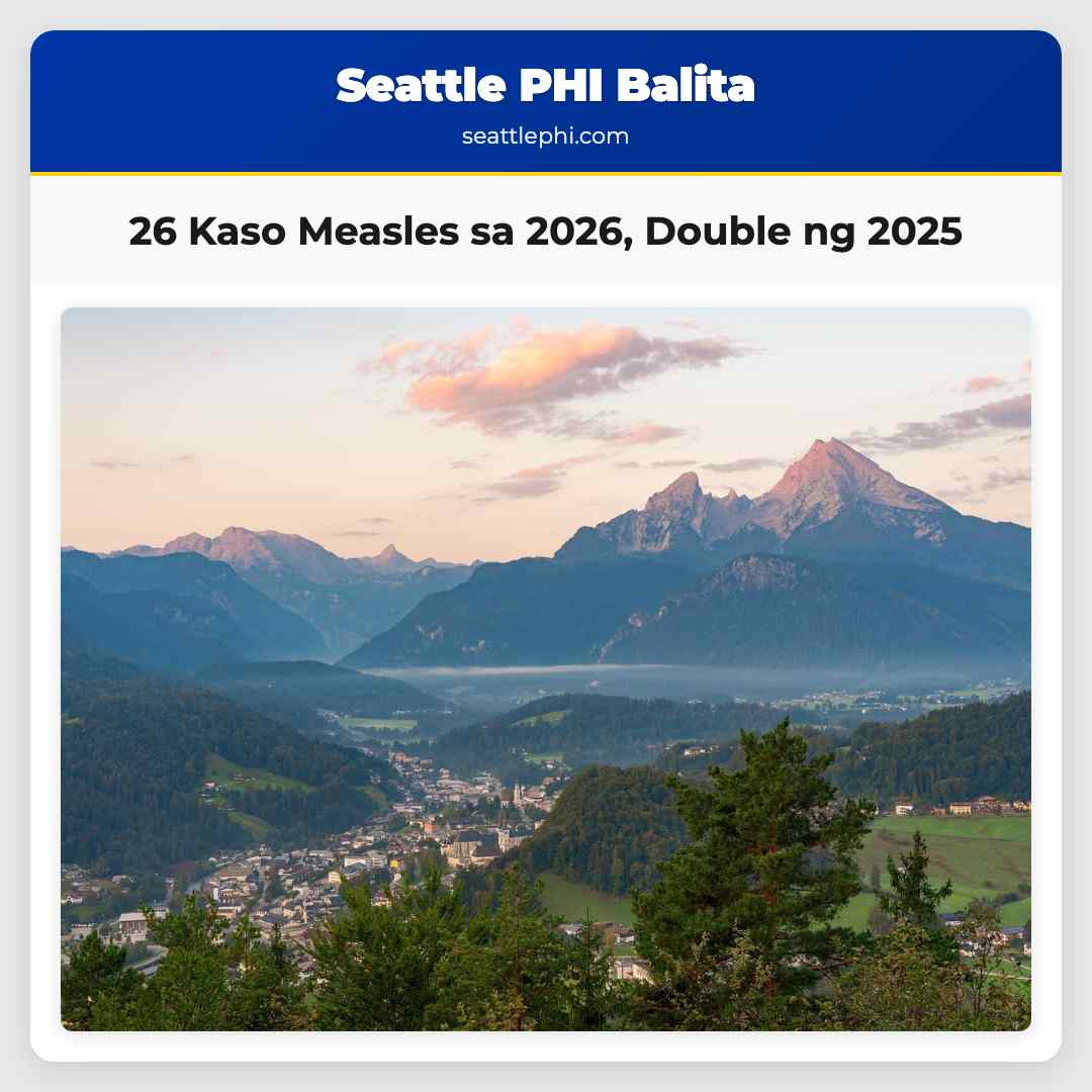 26 Kaso Measles sa 2026, Double ng 2025