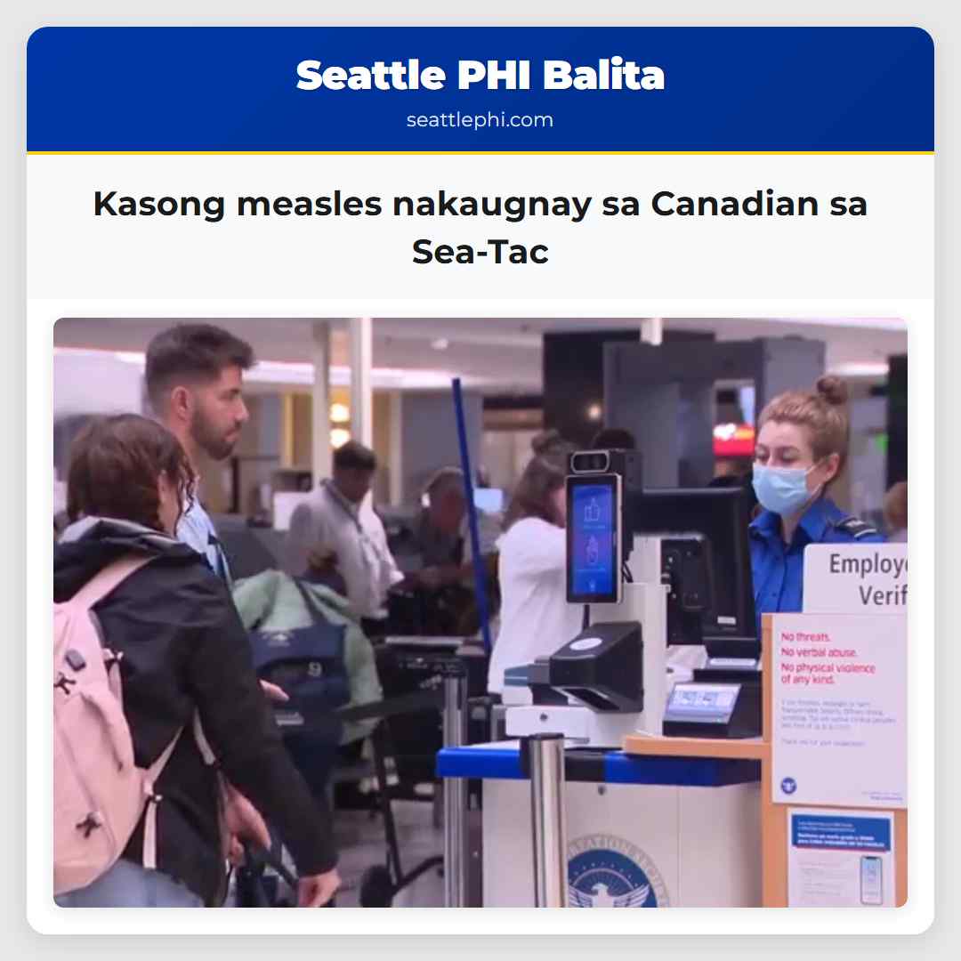 Kasong measles nakaugnay sa Canadian sa Sea-Tac