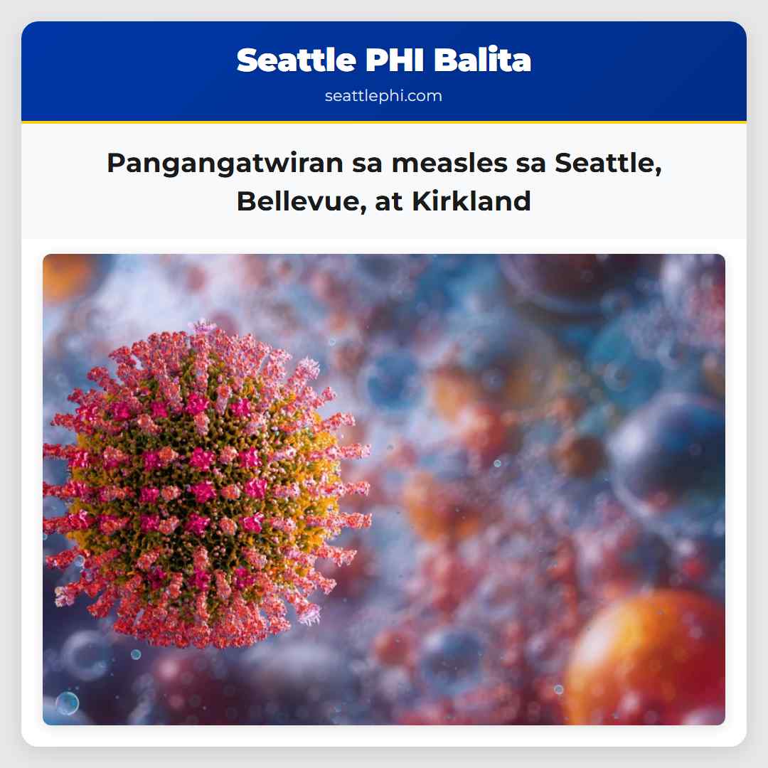 Pangangatwiran sa measles sa Seattle, Bellevue,